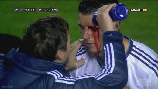 Ronaldo a ajuns la SPITAL dupa meciul cu Levante: NU mai putea sa VADA! Accidentarea horror care l-a speriat pe Mourinho! Cum s-a nascut un nou erou la Madrid: