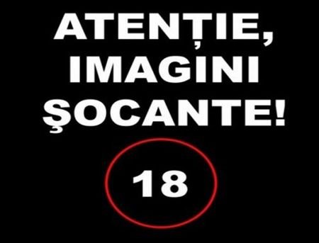 FOTO Englezii sunt SOCATI dupa incidentele de la Roma! Un suporter a ajuns cu capul CRAPAT la spital! Imagini interzise cardiacilor!_4