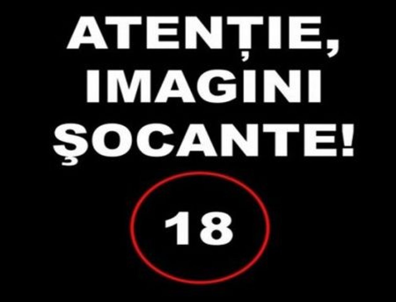 FOTO Englezii sunt SOCATI dupa incidentele de la Roma! Un suporter a ajuns cu capul CRAPAT la spital! Imagini interzise cardiacilor!_4