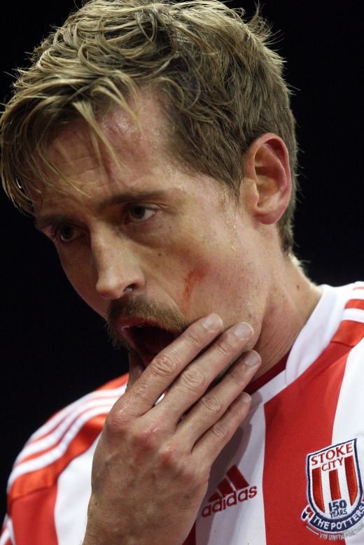 Peter Crouch si-a TUNAT zambetul! A pierdut doi dinti dupa un contact de K1: Doctore, cati mi-au mai ramas?? FOTO