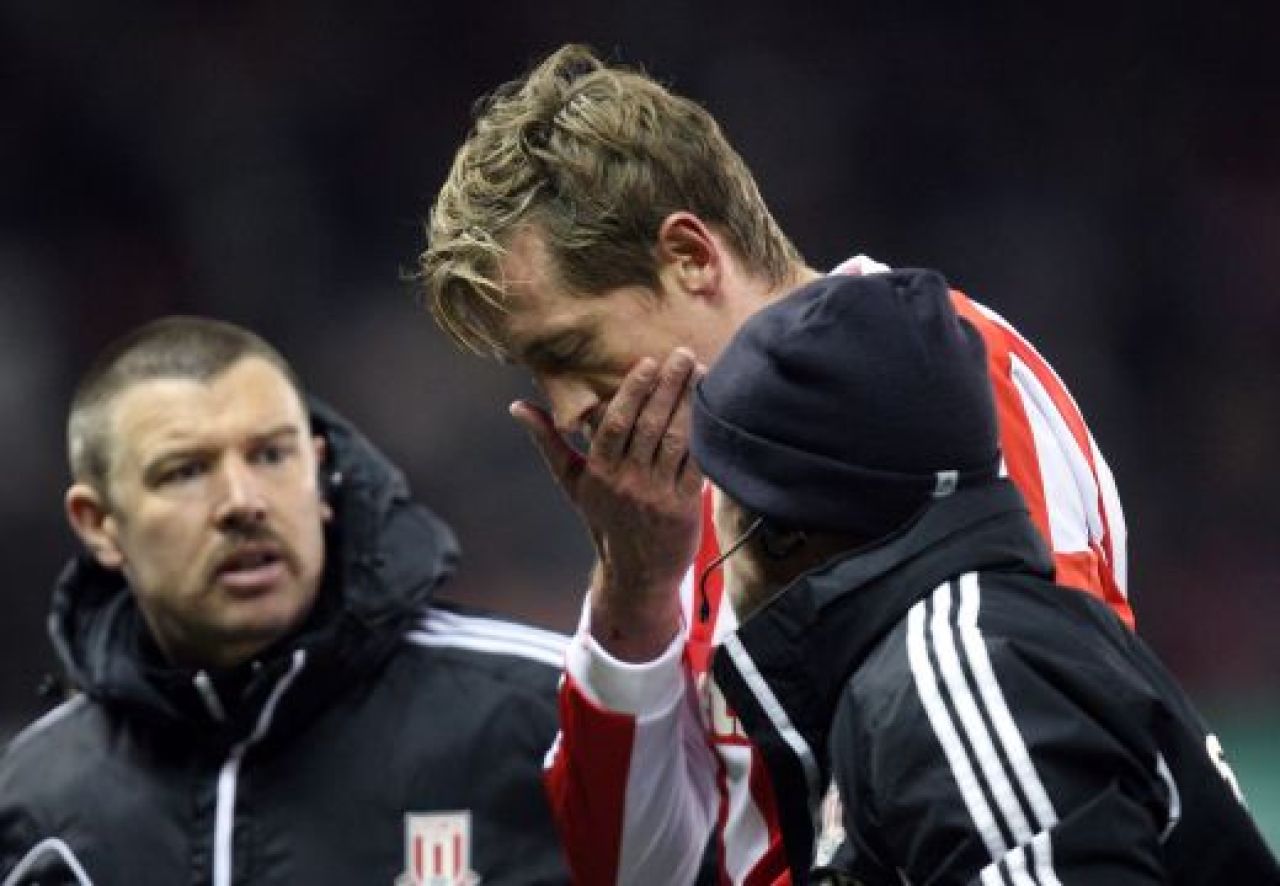 Peter Crouch si-a TUNAT zambetul! A pierdut doi dinti dupa un contact de K1: