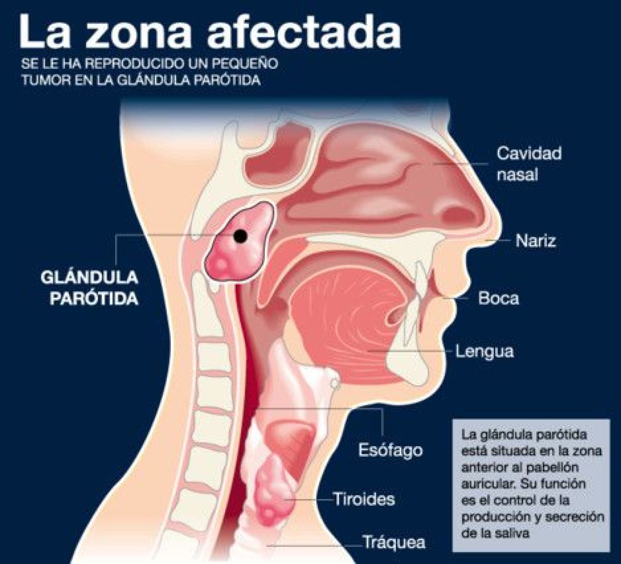 Spania se ROAGA pentru Tito! UPDATE: Vilanova a iesit din operatie! Medicii nu vor sa spuna nimic! Oficialii Barcei au dat primul comunicat oficial:_4