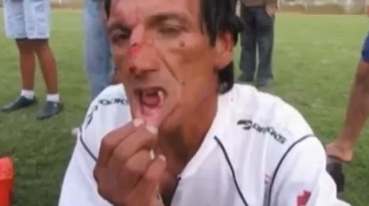 Arbitrul asta nu o sa mai fluiere NICIODATA! Jucatorii l-au batut pana i-au scos toti dintii! VIDEO SOCANT: