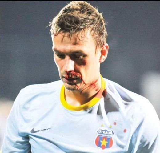 In sfarsit o veste buna pentru Reghe: Szukala are sanse sa joace cu Ajax! Verdictul medicilor: comotie si fractura! FOTO_2