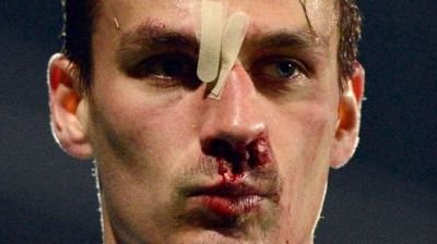 In sfarsit o veste buna pentru Reghe: Szukala are sanse sa joace cu Ajax! Verdictul medicilor: comotie si fractura! FOTO_3