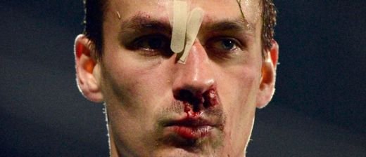 In sfarsit o veste buna pentru Reghe: Szukala are sanse sa joace cu Ajax! Verdictul medicilor: comotie si fractura! FOTO_4