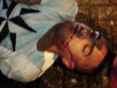 Scene HALUCINANTE cu un fotbalist de la Newcastle: a fost bagat in COMA dupa o bataie de strada! De la ce a pornit scandalul! VIDEO 18+