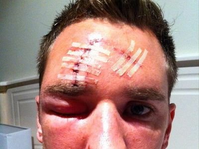 Ouch! Iti vine sa crezi ca arbitrul nu a dat nici macar fault la faza in care acest fotbalist a fost DESFIGURAT? Vezi toata faza VIDEO