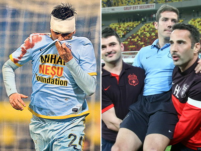 KILLERUL DODEL! Chipciu sta pe bara trei luni dupa ce a fost lovit de Tanase! Are FRACTURA de tibie: revine in preliminariile Champions League!_4