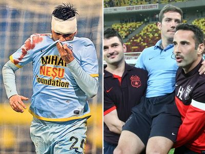 KILLERUL DODEL! Chipciu sta pe bara trei luni dupa ce a fost lovit de Tanase! Are FRACTURA de tibie: revine in preliminariile Champions League!_4