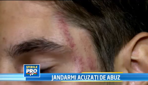 Acuzatii INCREDIBILE la adresa Jandarmeriei: pumni si picioare in stanga si-n dreapta! Un suporter a fost batut groaznic in Bucuresti: