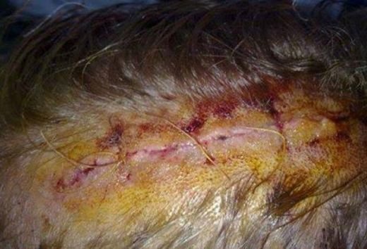 FOTO HORROR! Fotbalist englez, batut crunt in Romania! I-au dat cu toporul in cap si i-au distrus masina! Imagini incredibile:_2