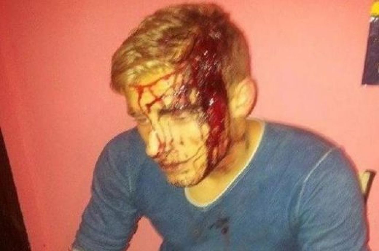 FOTO HORROR! Fotbalist englez, batut crunt in Romania! I-au dat cu toporul in cap si i-au distrus masina! Imagini incredibile:_3