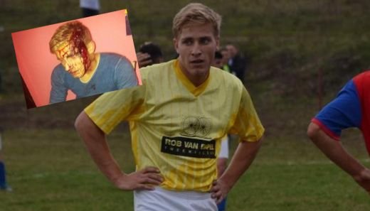 FOTO HORROR! Fotbalist englez, batut crunt in Romania! I-au dat cu toporul in cap si i-au distrus masina! Imagini incredibile:_4