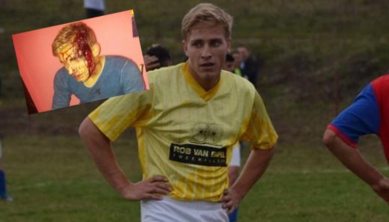 FOTO HORROR! Fotbalist englez, batut crunt in Romania! I-au dat cu toporul in cap si i-au distrus masina! Imagini incredibile:_4