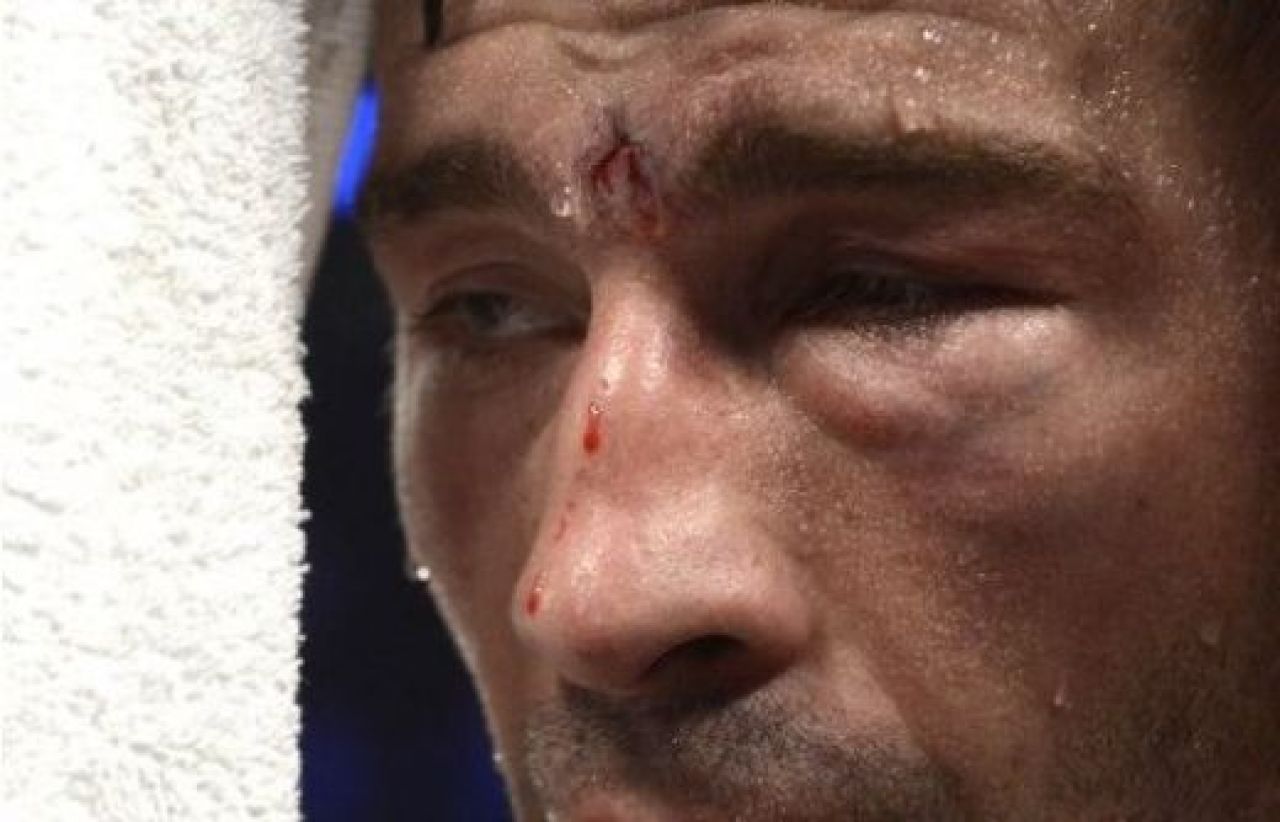 Imagine ce cu greu poate fi vazuta de fanii lui Lucian Bute! Are fata SPARTA dupa meciul cu Jean Pascal! FOTO ORIBIL_3