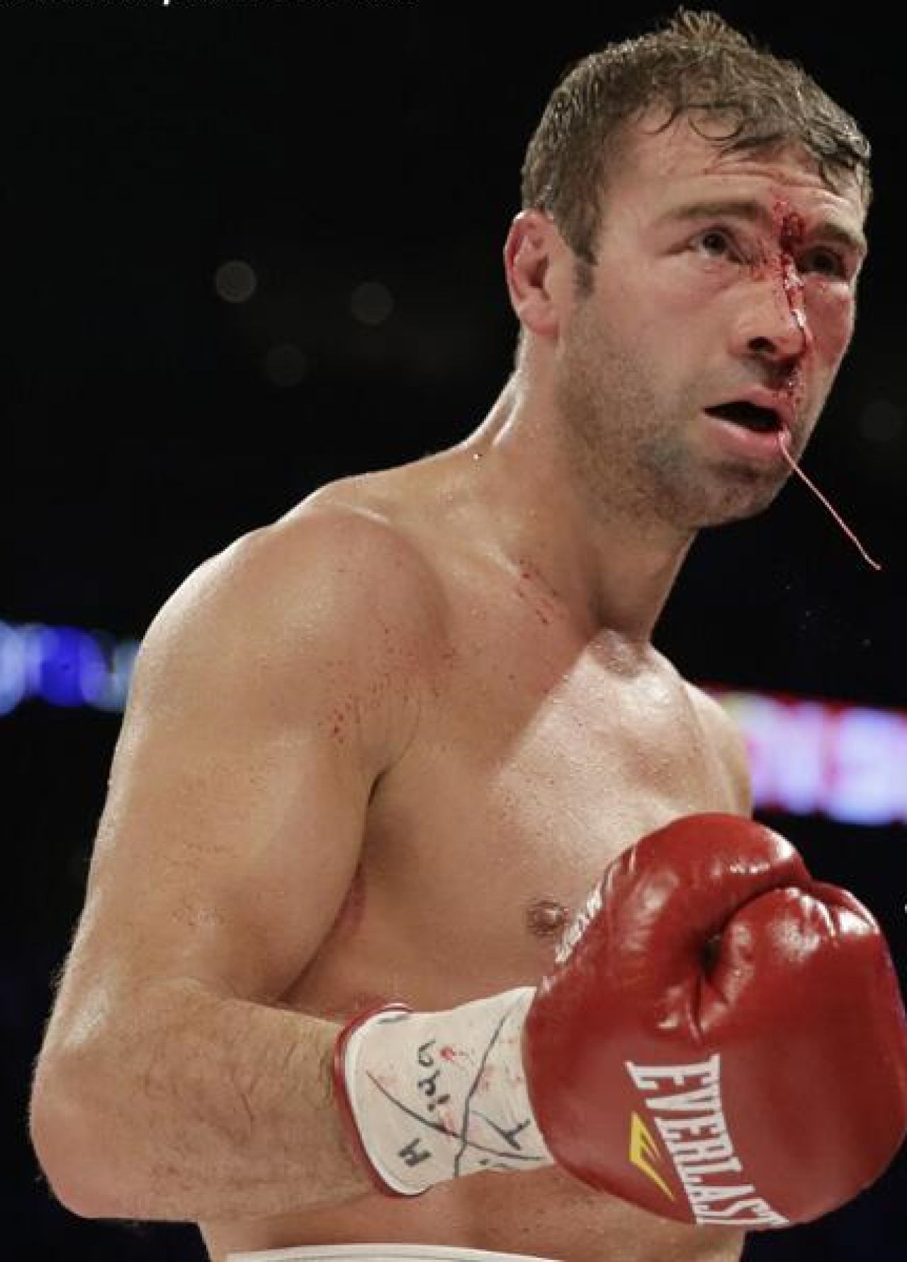 Imagine ce cu greu poate fi vazuta de fanii lui Lucian Bute! Are fata SPARTA dupa meciul cu Jean Pascal! FOTO ORIBIL_2
