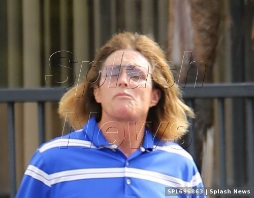 FOTO Operatia UNICA la care a recurs un fost IDOL al Americii. Nimeni nu intelege de ce a facut asta: