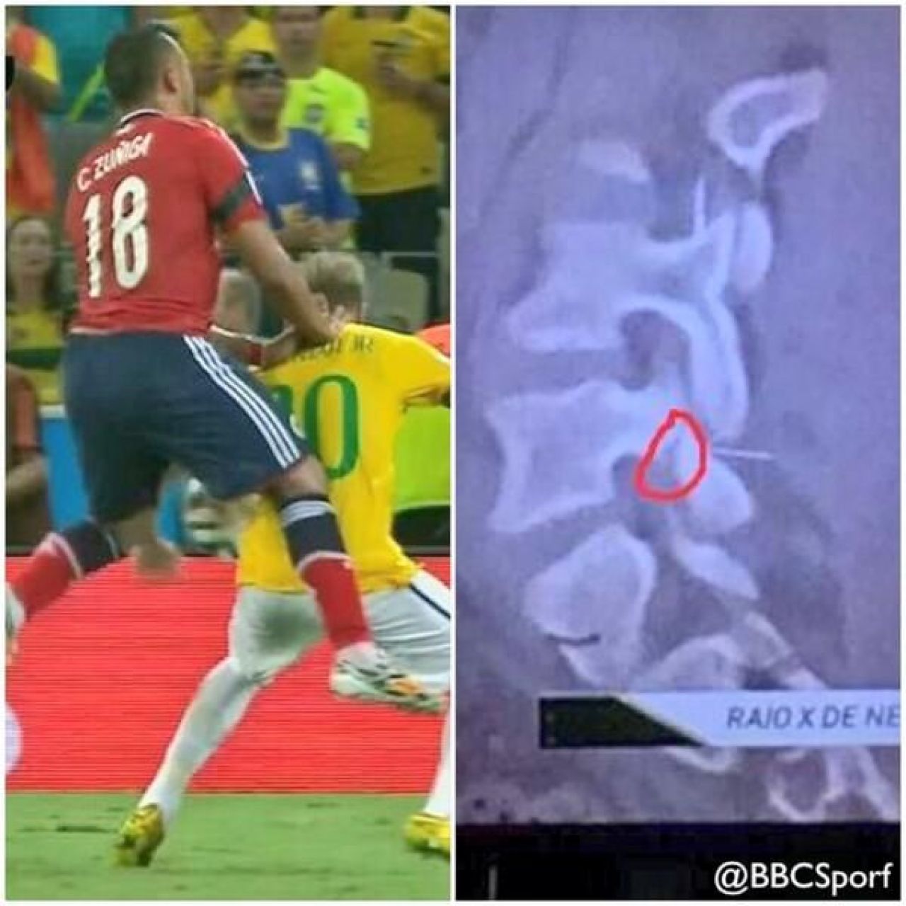 FOTO CUTREMURATOR! Neymar putea sa aiba soarta lui Nesu! Brazilianul a fost la 2 cm de drama! _1