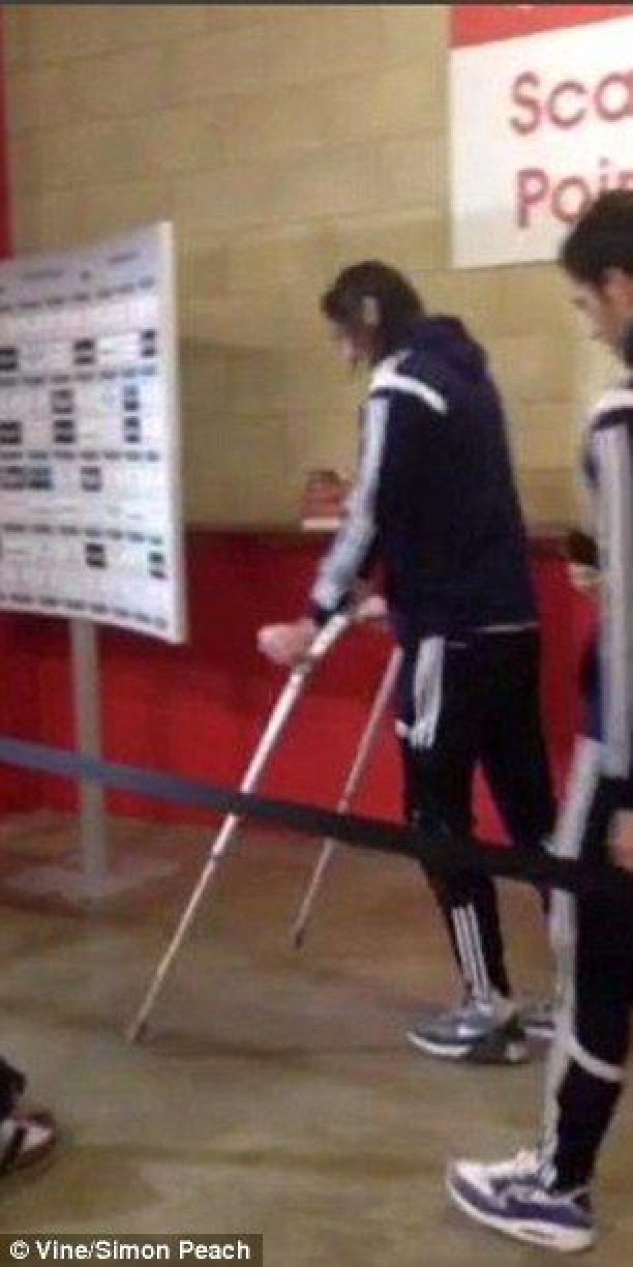 IMAGINI SOCANTE! Cum arata in acest moment piciorul lui Andy Carroll, dupa ce s-a operat. Va rata tot restul sezonului. FOTO_1