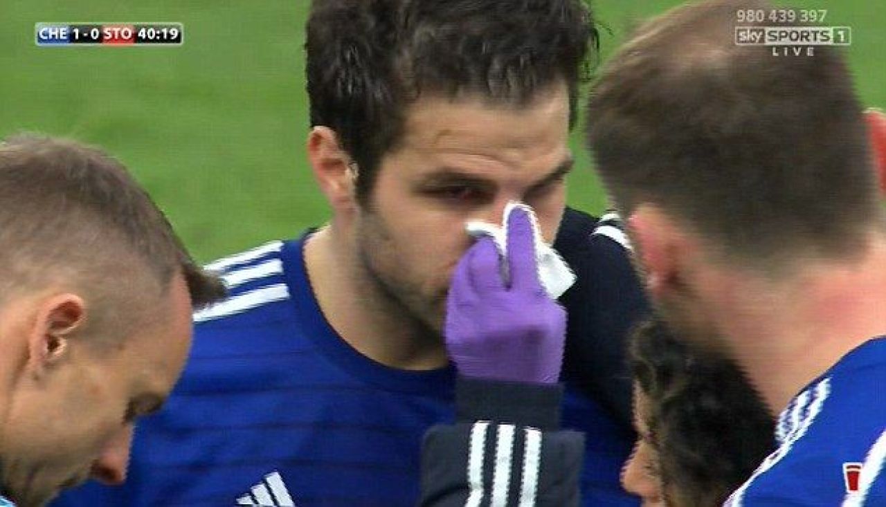 Cum arata fata lui Fabregas dupa ultima accidentare in Premier League. A ajuns la spital dupa asta. FOTO_2