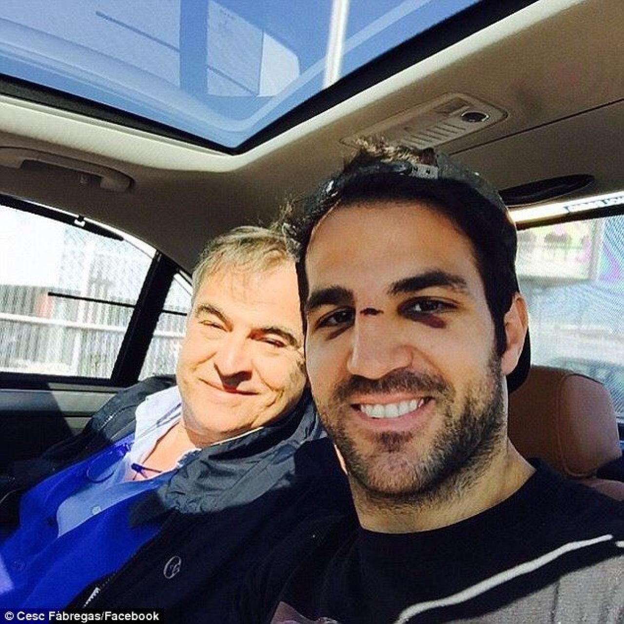 Cum arata fata lui Fabregas dupa ultima accidentare in Premier League. A ajuns la spital dupa asta. FOTO_3
