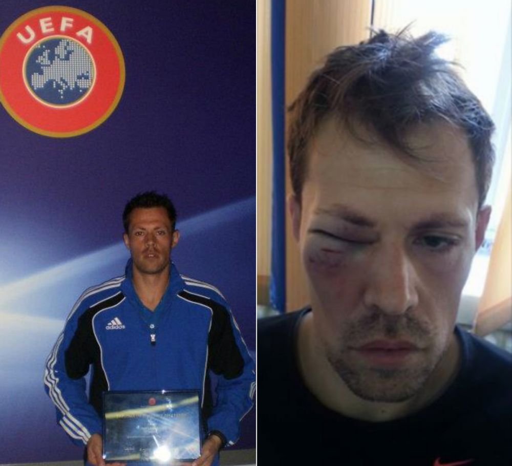 SOCANT! Un arbitru a fost batut in timp ce se antrena. Imagini socante cu tanarul tusier: 