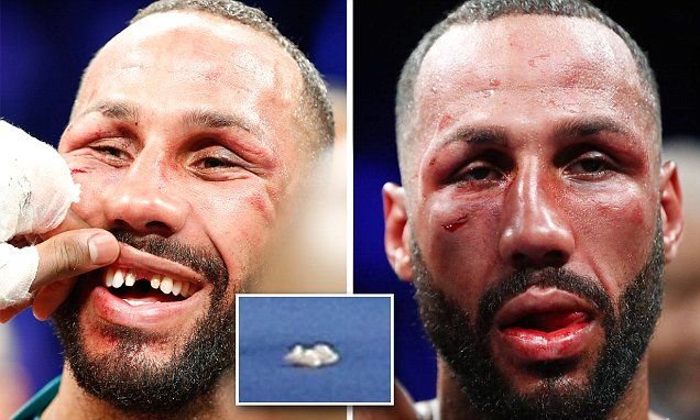 I-a scos dintii in ring! Imagini incredibile la finalul luptei lui Badou Jack cu DeGale! Cum aratau cei doi