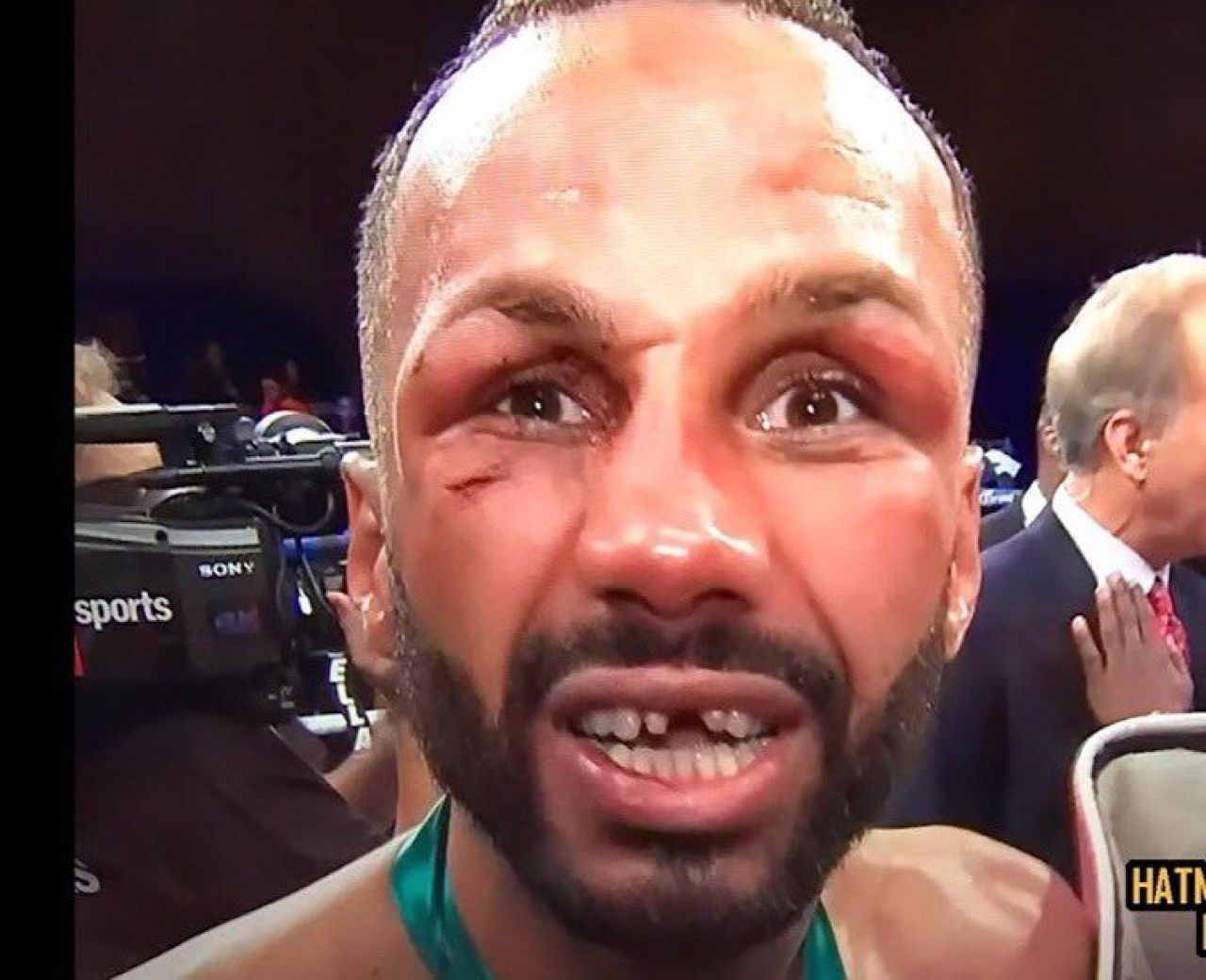 Imaginea anului in box. Cum arata fata acestui boxer dupa un meci care s-a terminat EGAL :)) FOTO_1