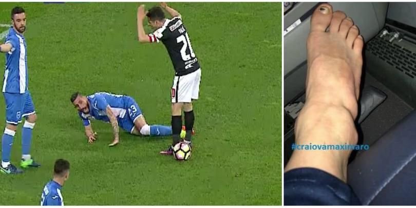 Imagine socanta: cum arata glezna lui Zlatinski dupa intrarea lui Palic. Bulgarul Craiovei are piciorul 