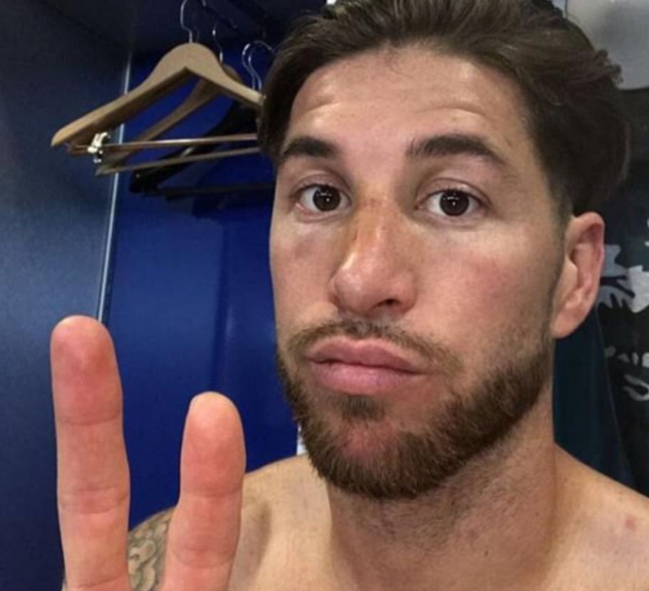 Cum arata Sergio Ramos dupa ce s-a ales cu fractura de piramida nazala la derbyul cu Atletico: FOTO_1