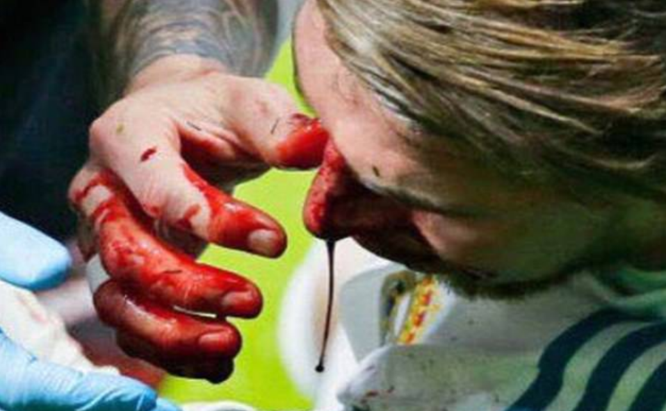 Cum arata Sergio Ramos dupa ce s-a ales cu fractura de piramida nazala la derbyul cu Atletico: FOTO_2