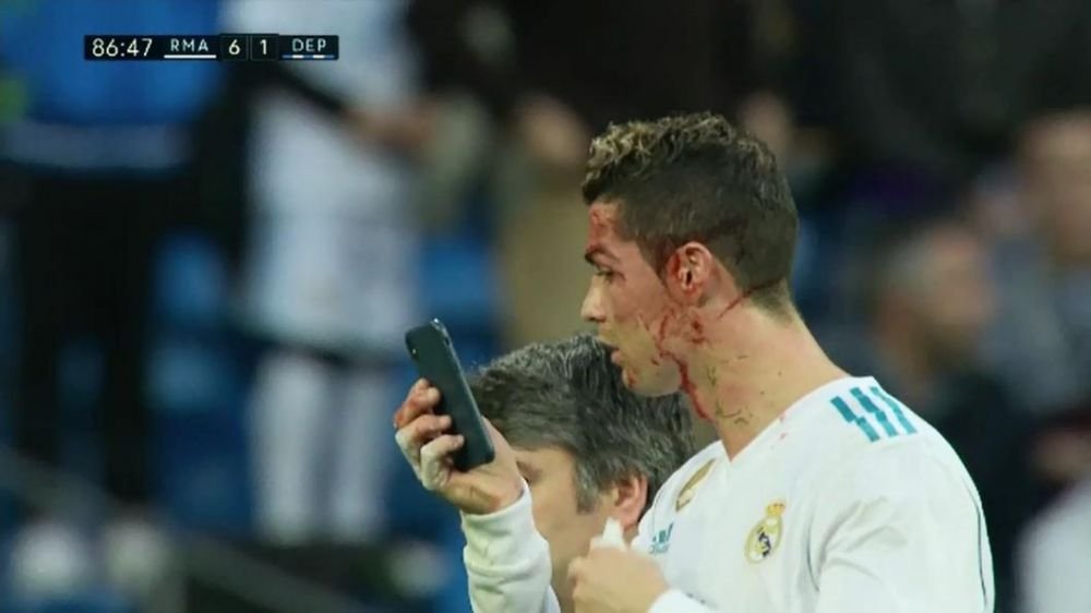 PLIN DE SANGE! Imagini horror cu Ronaldo la vestiar! Cum a ajuns dupa meciul cu Deportivo. VIDEO