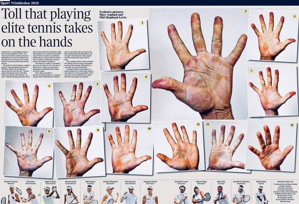Wimbledon 2018. SACRIFICIUL IMENS al jucatorilor de tenis. Cum arata palmele Simonei Halep si ale altor jucatori de top