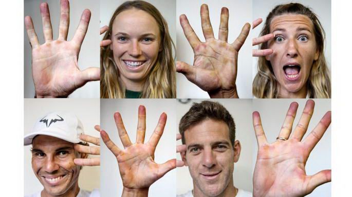Wimbledon 2018. SACRIFICIUL IMENS al jucatorilor de tenis. Cum arata palmele Simonei Halep si ale altor jucatori de top_3