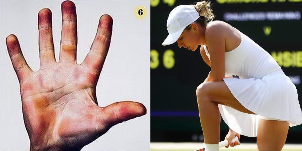 Wimbledon 2018. SACRIFICIUL IMENS al jucatorilor de tenis. Cum arata palmele Simonei Halep si ale altor jucatori de top_4