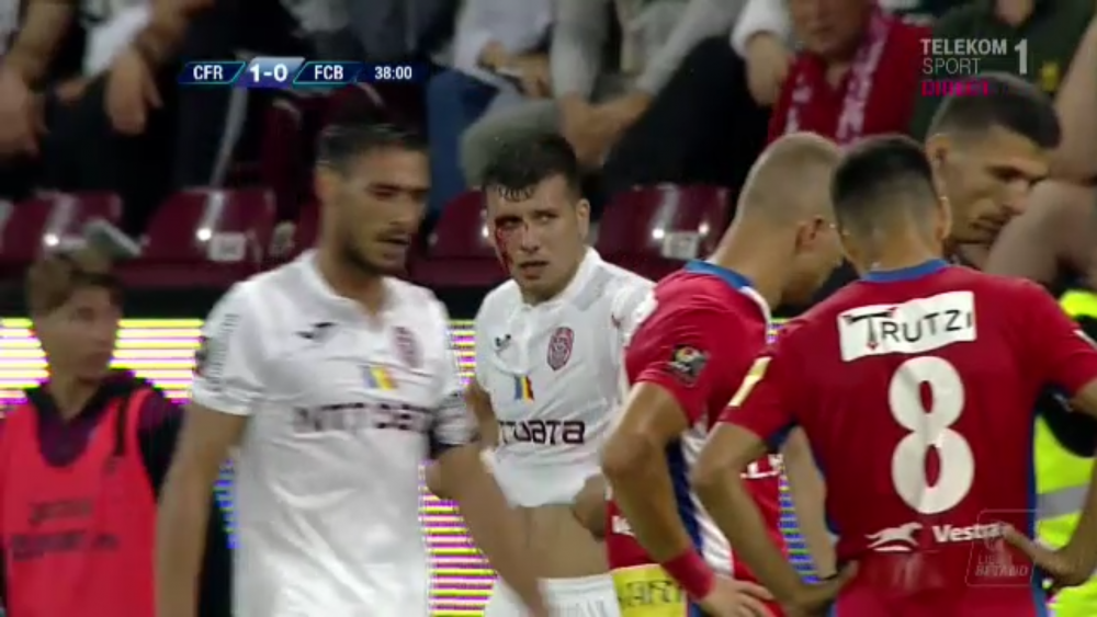 Tucudean si-a SPART CAPUL si a INNEBUNIT de nervi in timpul meciului! Imagini INCREDIBILE la Cluj_3