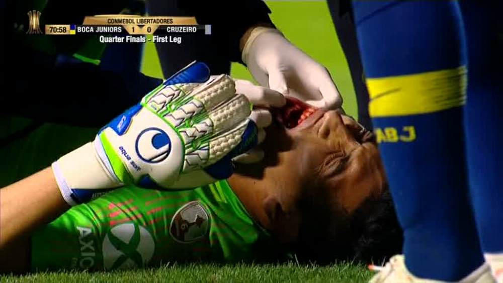 I-a SPART dintii portarului cu capul! Incident dramatic in Copa Libertadores! VIDEO