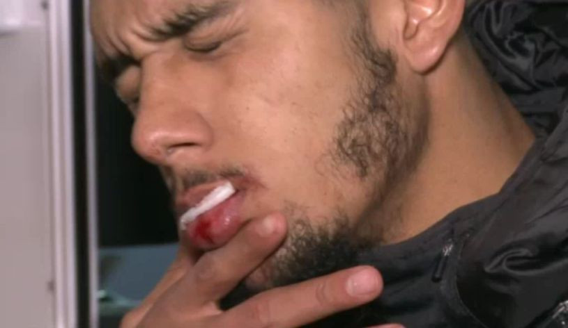 Scandalos! Un jucator din Liga I nu a fost dus la spital dupa accidentare pentru ca nu avea actele la el: Nu e urgenta, nu moare