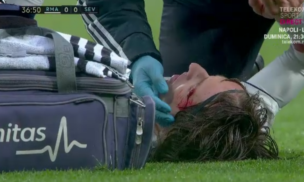 Imagini DE COSMAR pe Bernabeu! Modric, plin de sange dupa un duel aerian | FOTO_2