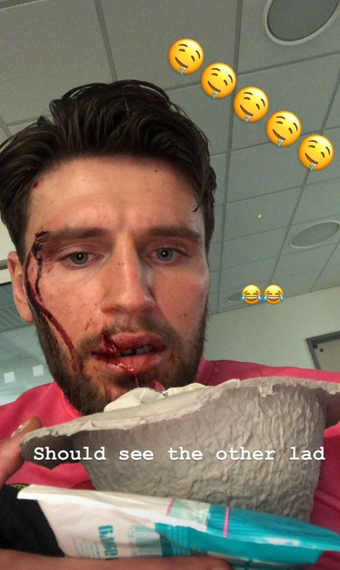 Accidentare groaznica in Anglia! Portarul a ajuns la spital dupa ce a fost lovit cu crampoanele peste fata! Mesajul sau a devenit viral!_3