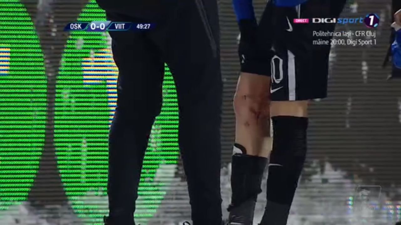 FOTO | Intrare criminala a lui Viera la Ianis Hagi! Ivorianul de la Sepsi a scapat usor, Hagi a luat foc! Cum arata piciorul lui Ianis_3