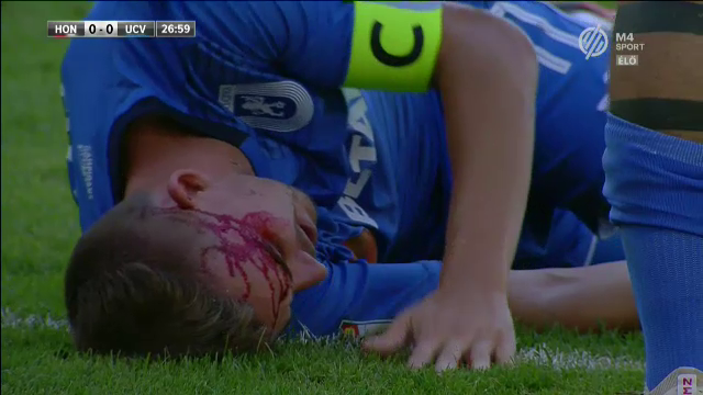HONVED - CRAIOVA | Momente socante la Gyor! Bancu, plin de sange pe teren! Partida a fost intrerupta 6 minute!_2
