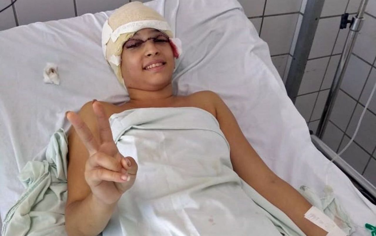 Accident infiorator la un concurs! Unei fete de 19 ani i-a fost smuls complet parul:
