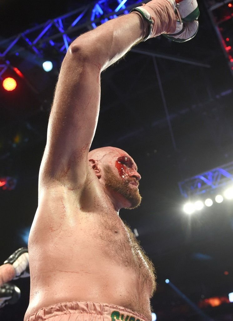 Tyson Fury, meci ULUITOR: si-a invins adversarul cu fata plina de sange si a fost dus la spital. FOTO_2