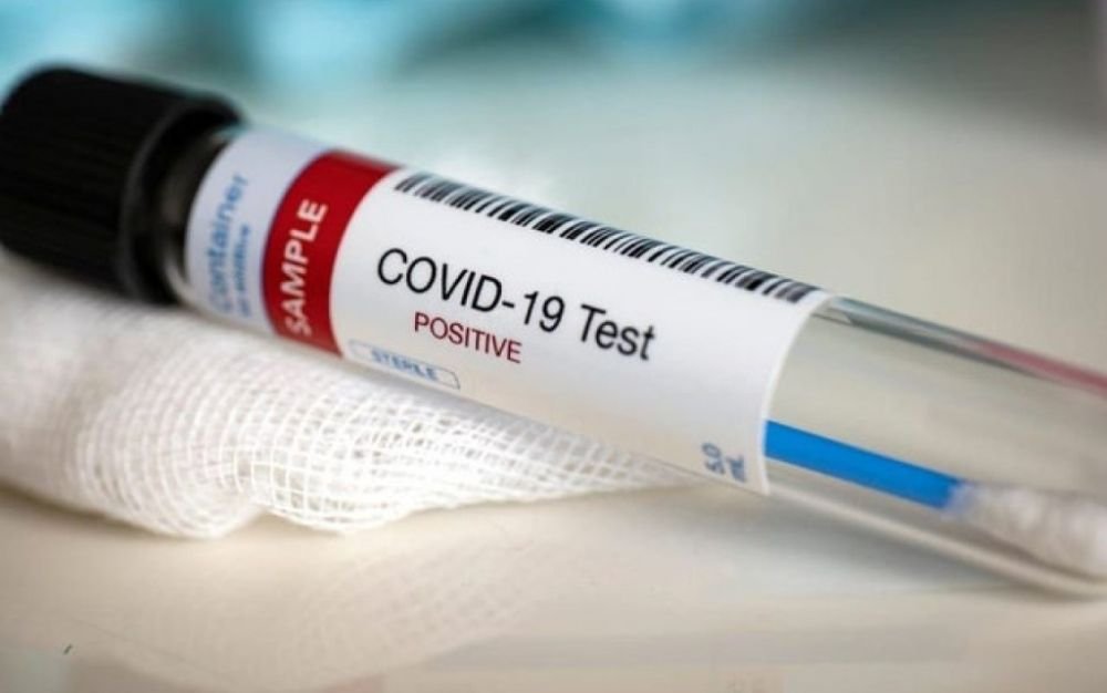 Tara din Europa care tocmai a anuntat ca vrea sa testeze 25 de milioane de oameni pentru coronavirus! Actiune GIGANT pentru controlul bolii! Ce categorii de persoane vor fi testate