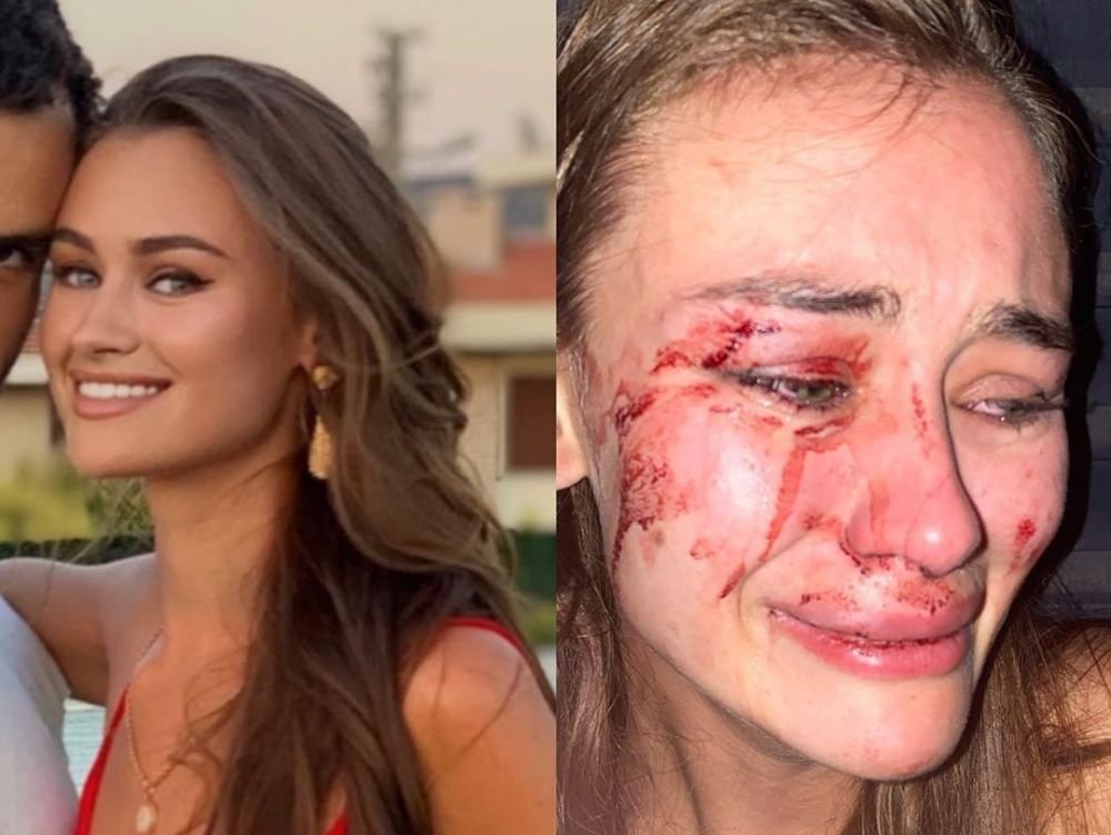 Modelul care sustine ca a fost batuta cu BESTIALITATE de paznicii hotelului in care statea! Ce s-ar fi intamplat de fapt _10