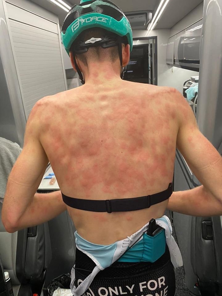 Imagini HORROR cu doi ciclisti dupa ce a inceput o furtuna de gheata pe traseu! Cum poate arata corpul lor _2