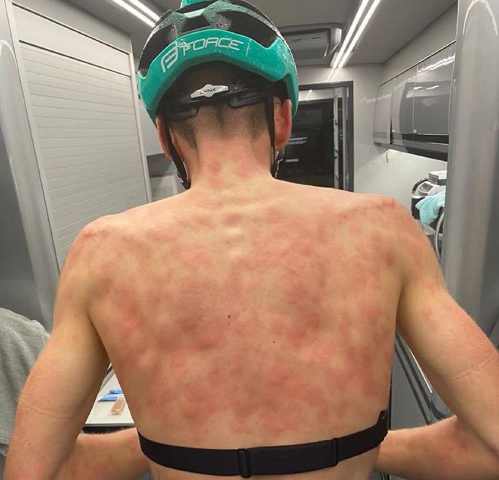 Imagini HORROR cu doi ciclisti dupa ce a inceput o furtuna de gheata pe traseu! Cum poate arata corpul lor _4