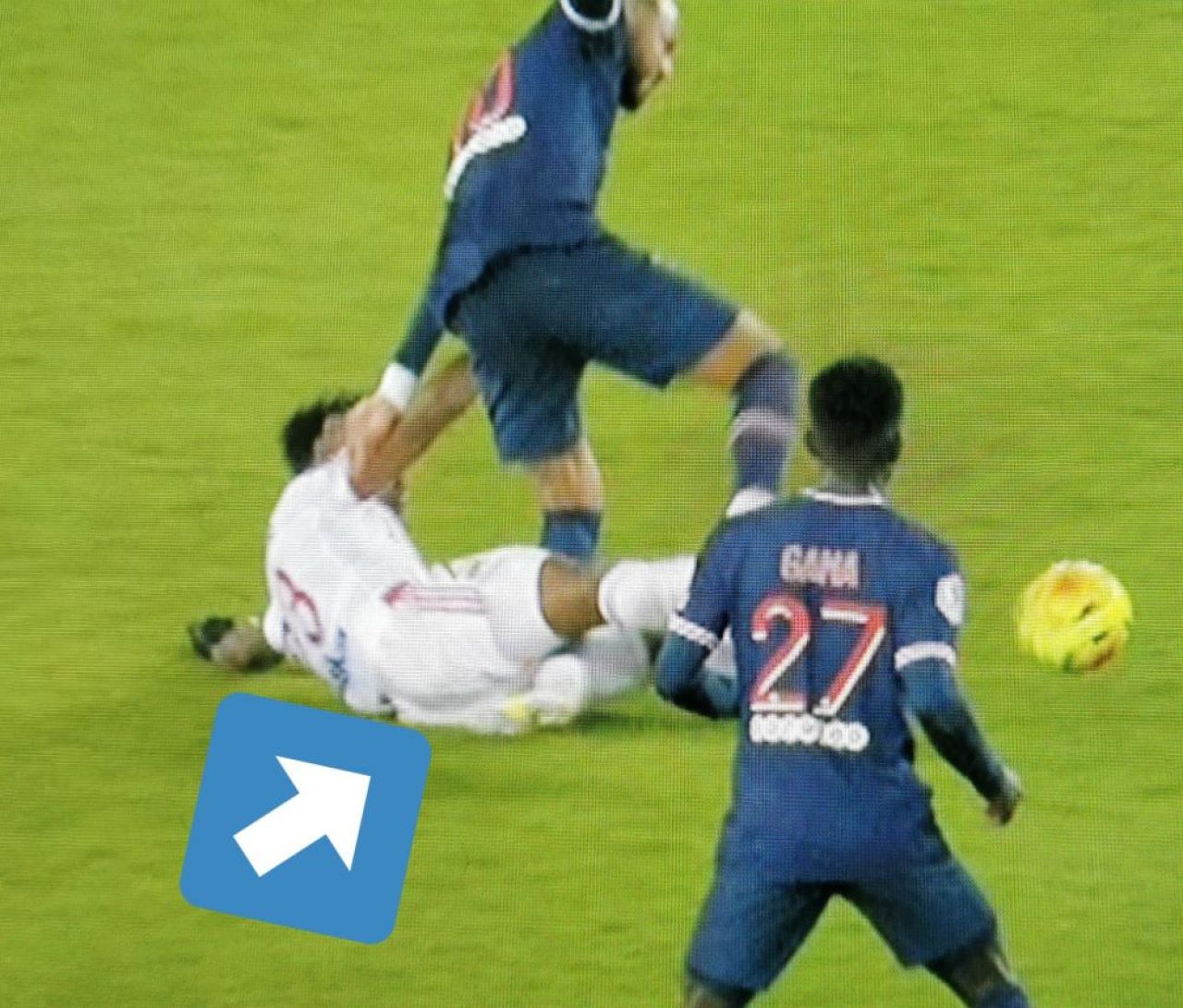 ATENTIE, IMAGINI SOCANTE! Neymar, accidentare CUTREMURATOARE! A inceput sa urle de durere si sa planga! Stirea face inconjurul lumii_2